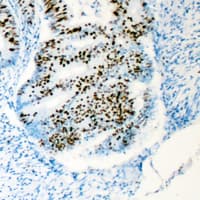 HCF1 / HCFC1 Antibody (N-Terminus)