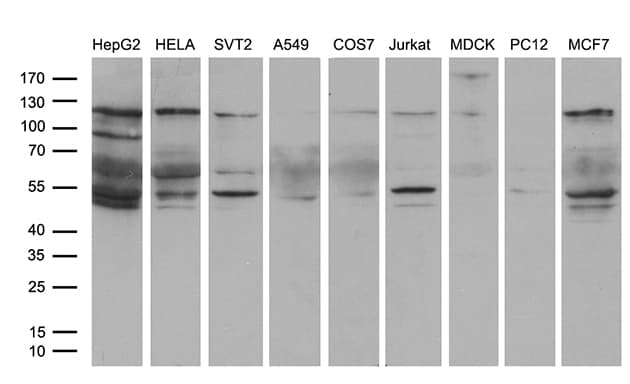 EPHA6 / EPH Receptor A6 Antibody (aa225-481, clone OTI5B9, Carrier-free)