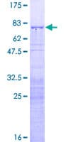 Human RRS1 Protein (Recombinant GST)