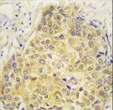 SEMA3A / Semaphorin 3A Antibody (aa535-566)