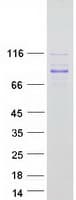 Human MYSM1 Protein (Recombinant Myc-DDK (Flag))