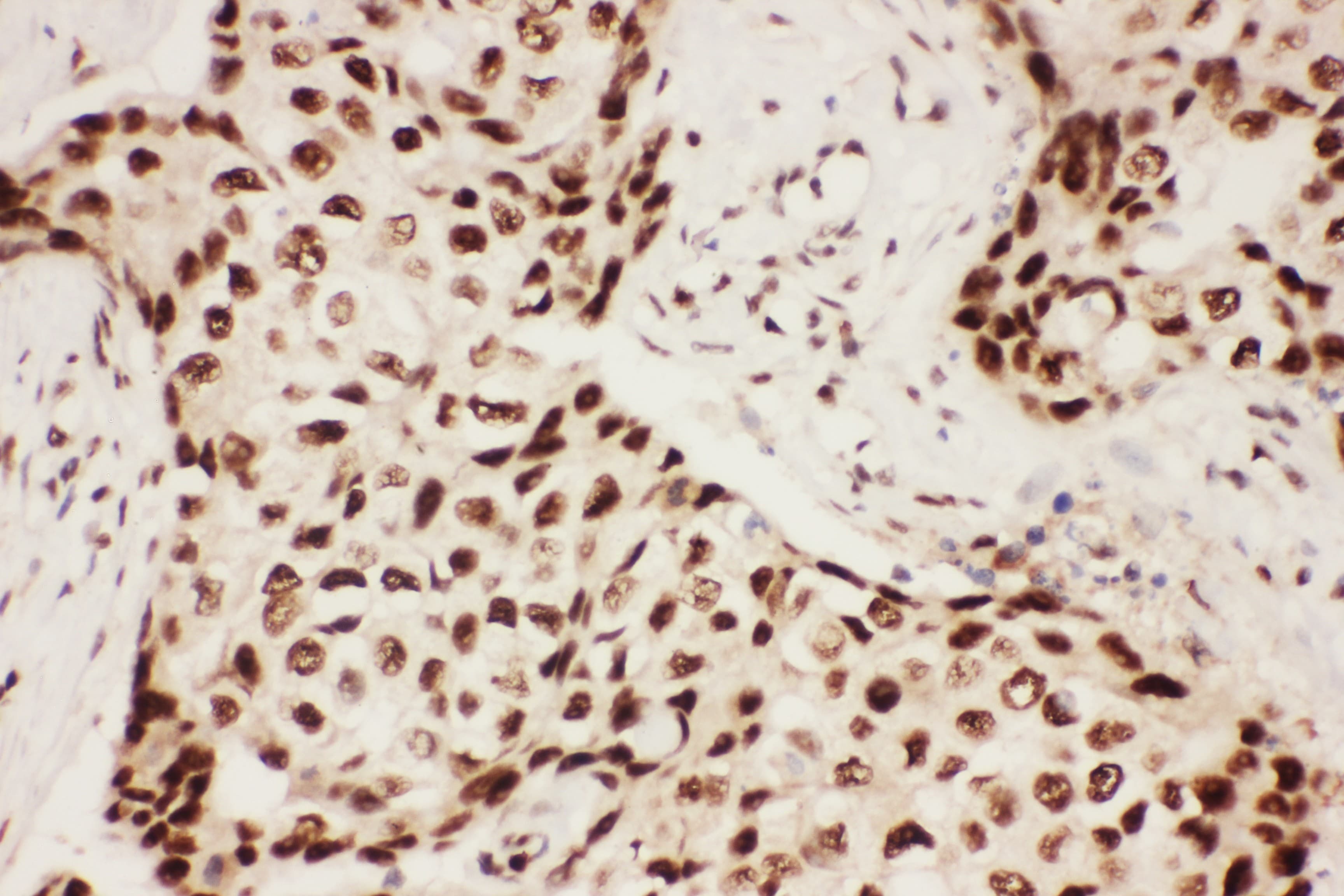 ALOX5 / 5-LOX Antibody (aa120-483)