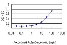 ITGB2 / CD18 Antibody (clone 5F12)