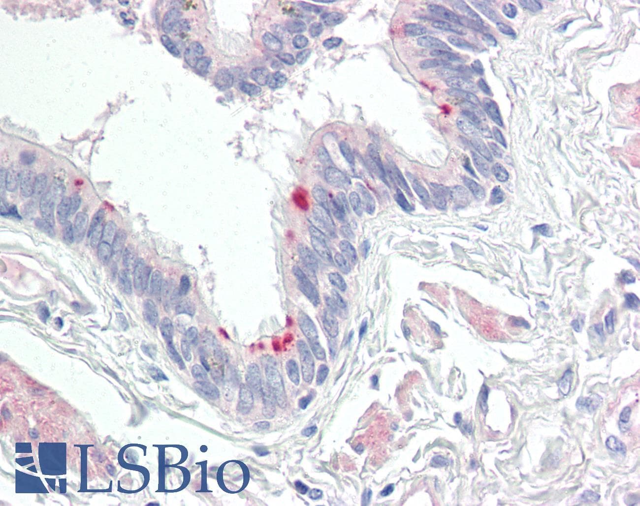 IHC-plus™ MRPL24 Antibody (aa101-150)