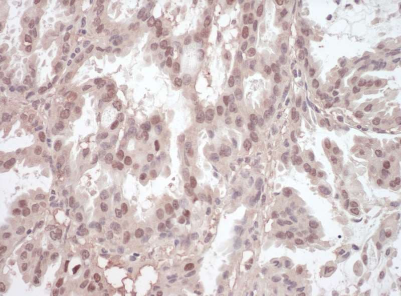 IHC-plus™ Polyclonal Rabbit anti-Human TRAF4 Antibody (aa420-470, IHC)