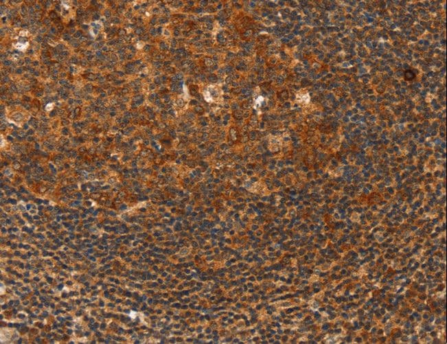 HDAC8 Antibody