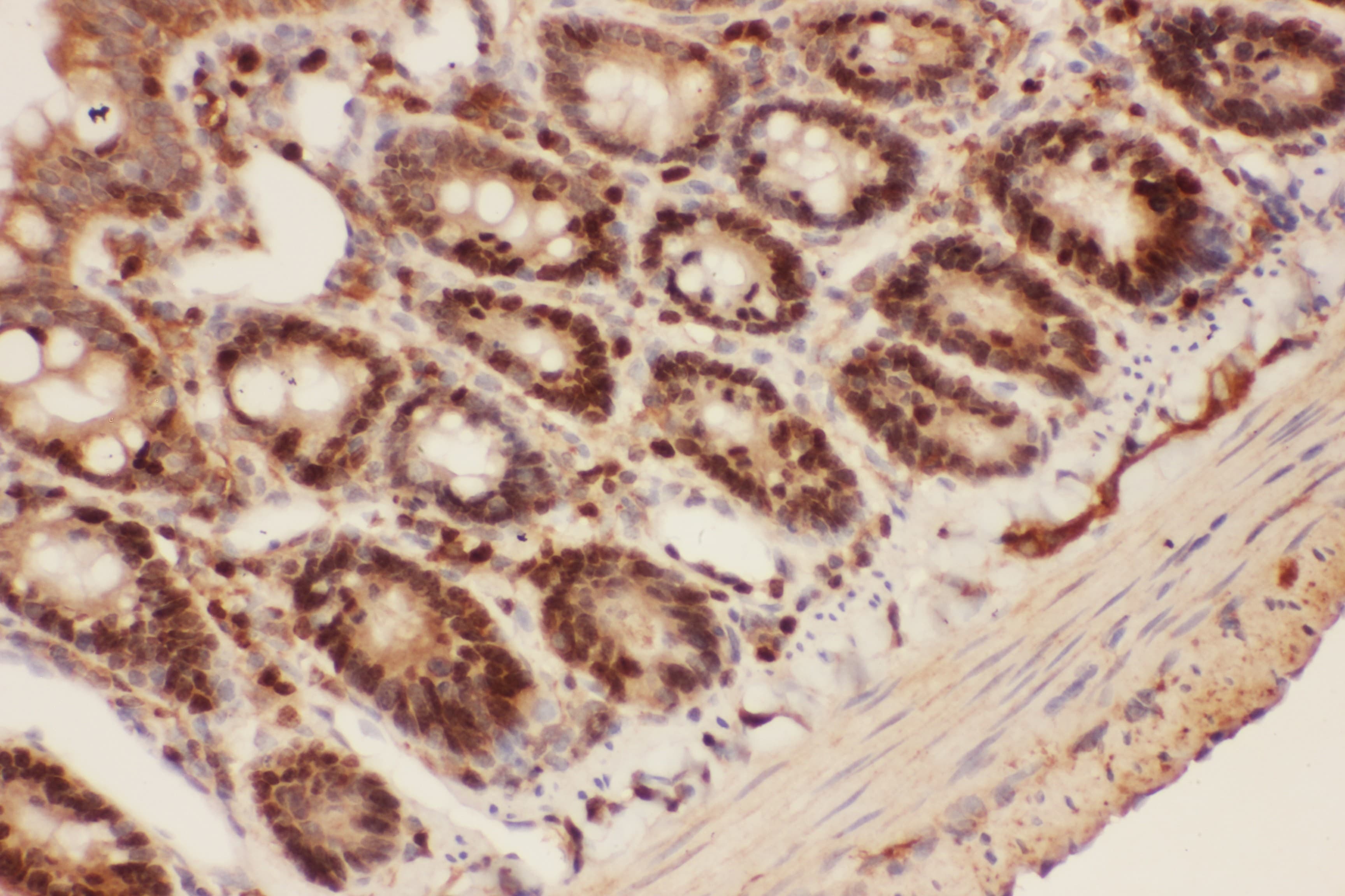 BECN1 / Beclin-1 Antibody (aa1-354)