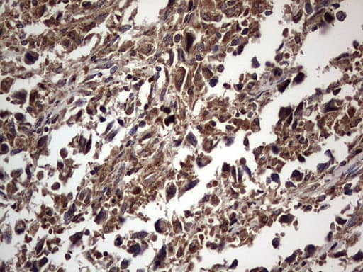 DOCK8 Antibody (aa832-1160, clone OTI4H10)