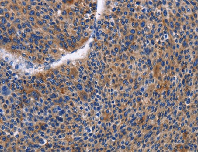 Polyclonal Rabbit anti-Human IGSF10 Antibody (IHC)