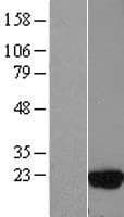 UBE2D3 / UBCH5C Protein (Over-Expression Lysate Myc-DDK (Flag))