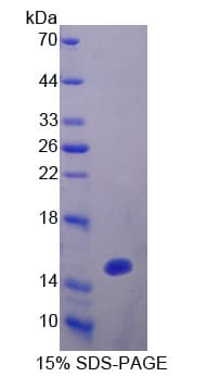 Human OCEL1 Protein (Recombinant His-T7)