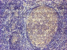 MAGEB18 Antibody (clone OTI9F9)
