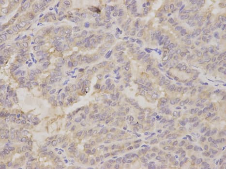 IHC-plus™ Polyclonal Rabbit anti-Human GOLGA2 / GM130 Antibody (IHC, IF, WB)