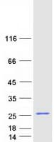 Human ZNF385C Protein (Recombinant Myc-DDK (Flag))