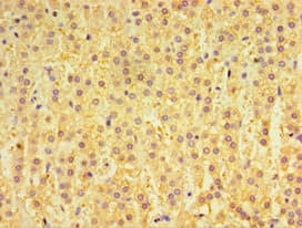 Polyclonal Rabbit anti-Human GPS1 / CSN1 Antibody (aa222-491, IHC)