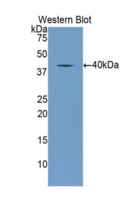 ESAM Antibody (aa31-390, PE)