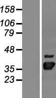 Human NUDT22 Protein (Over-Expression Lysate Myc-DDK (Flag))