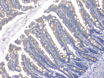 HDAC5 Antibody