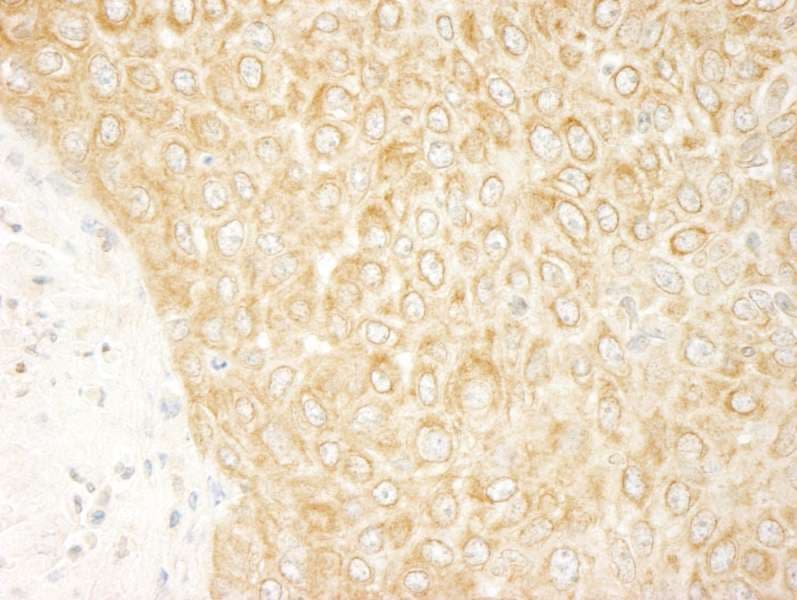 ZAK / MLTK Antibody (aa750-800)