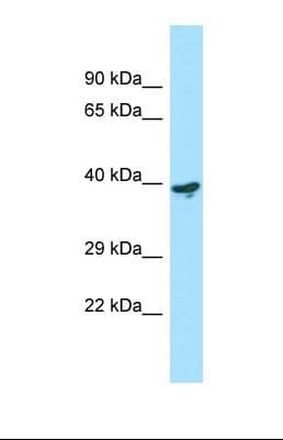 Polyclonal Rabbit anti-Human C4.4A / LYPD3 Antibody (aa262-311, WB)