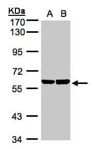TBRG4 Antibody (aa1-270)
