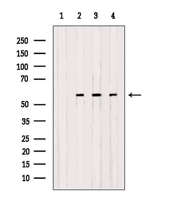 OXCT1 Antibody