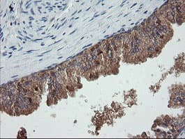 CATIP / C2orf62 Antibody (clone OTI4B4)