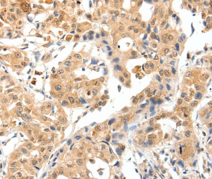 IHC-plus™ TPM2 Antibody