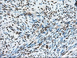 HMRF1L / MTRF1L Antibody (clone OTI2B5)