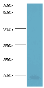 Polyclonal Rabbit anti-Human ACP1 / Acid Phosphatase Antibody (aa1-158, IHC, WB)