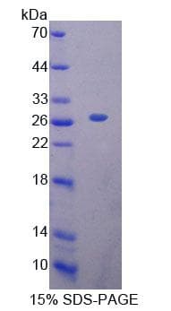 Human MTF-1 Protein (Recombinant His-T7)