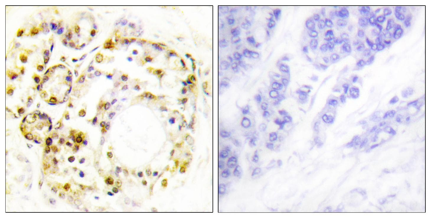 MAPK6 / ERK3 Antibody (phospho-Ser189)