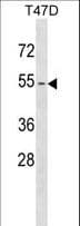 KRT79 / Keratin 79 Antibody (aa331-357)