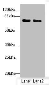 CBFA2T2 / MTGR1 Antibody