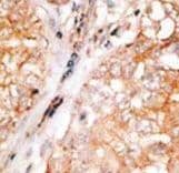 Polyclonal Rabbit anti-Human BCL2L2 / Bcl-w Antibody (aa24-59, IHC, WB)