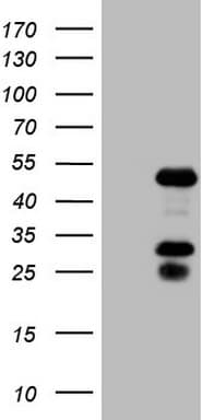 EAR2 / NR2F6 Antibody (clone OTI2H4)