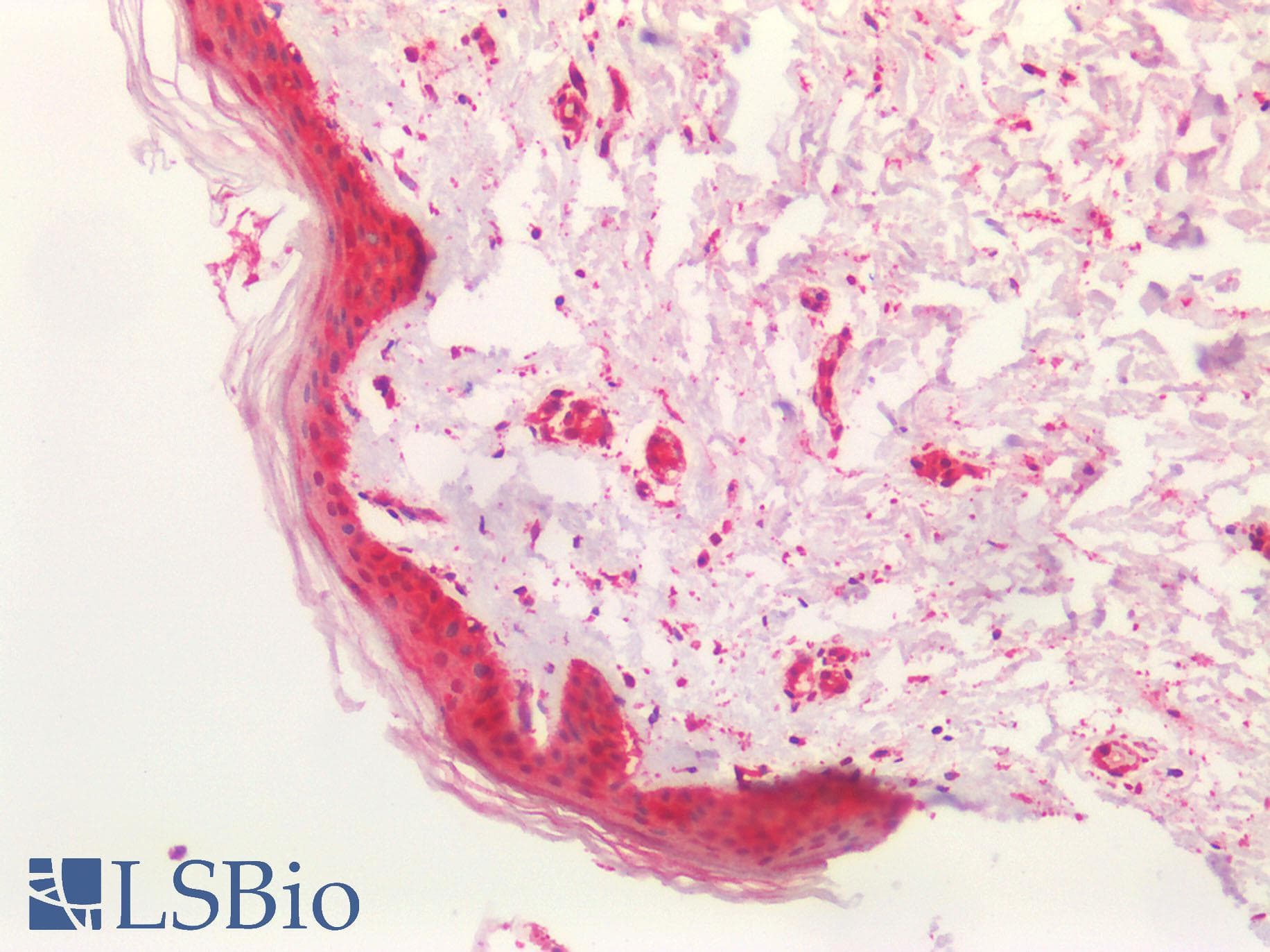 Polyclonal Rabbit anti-Human SMO / Smoothened Antibody (IHC, IF, WB)