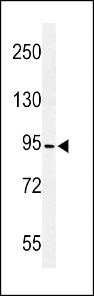 CCDC170 / C6orf97 Antibody (aa594-623)