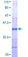 Human ST3GAL4 / ST3Gal IV Protein (Recombinant GST, N-terminus)