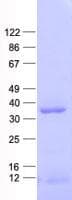 Human CDX1 Protein (Recombinant His, N-Terminal)