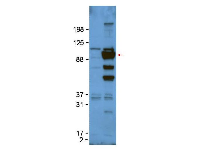 GPC1 / Glypican Antibody (Internal)