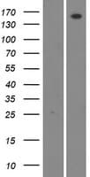 WNK4 Protein (Over-Expression Lysate Myc-DDK (Flag))