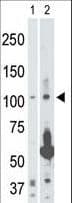 MAP3K14 Antibody (aa119-148)