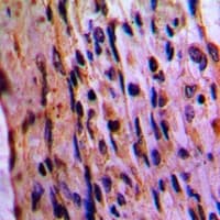 Polyclonal Rabbit anti-Human EIF3D Antibody (Internal, IHC, WB)