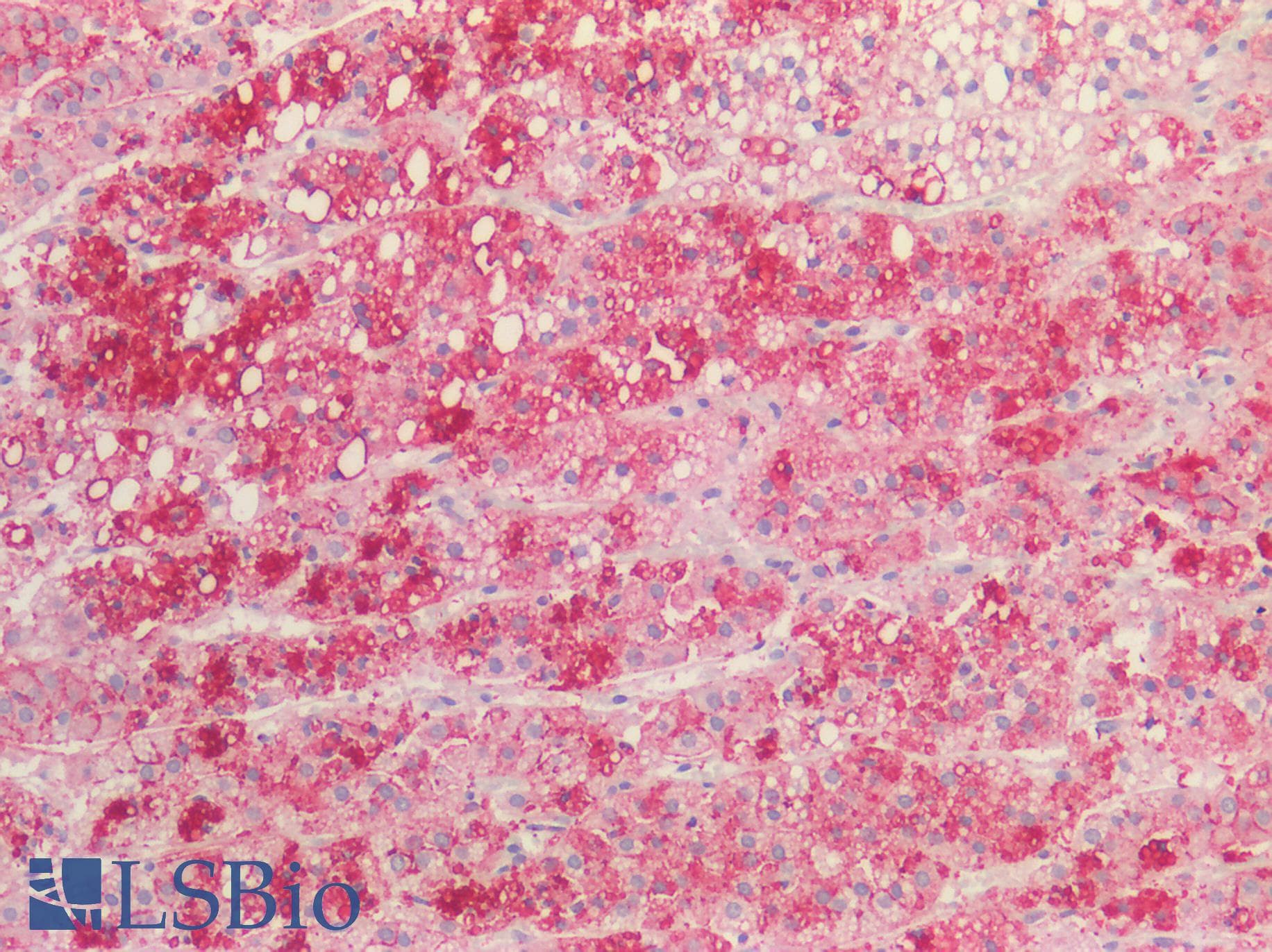 PathPlus™ Polyclonal Goat anti-Human APOE / Apolipoprotein E Antibody (aa305-317, IHC, WB)