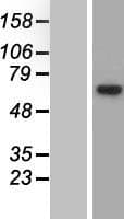 EEF1D Protein (Over-Expression Lysate Myc-DDK (Flag))