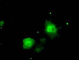 ERCC1 Antibody (clone OTI2A7)