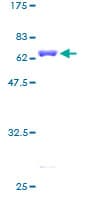 Human DCPS Protein (Recombinant GST)