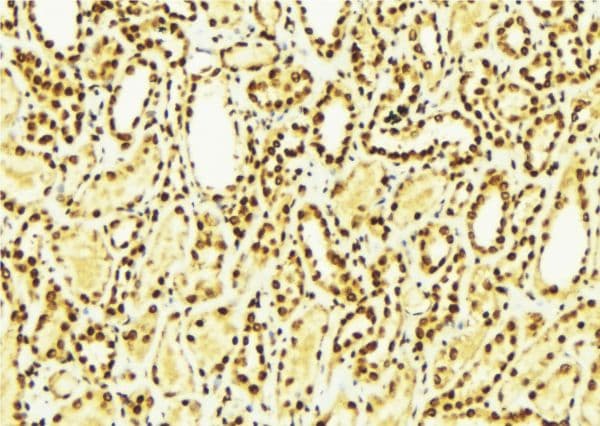 Polyclonal Rabbit anti-Human CLIC4 Antibody (IHC, IF, WB)