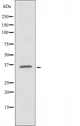 Polyclonal Rabbit anti-Human TMEPAI / PMEPA1 Antibody (IHC, IF, WB)